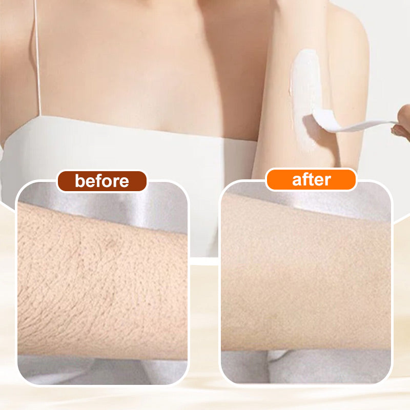 💥Buy 1 Get 1 Free🔥Versatile, Aromatic, Mild Formula Hair Removal Cream